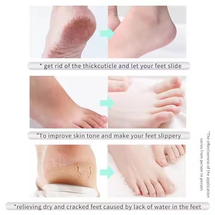 Lavender Exfoliating Foot Mask – Remove Dead Skin, Smooth & Moisturize Feet Customer Reviews