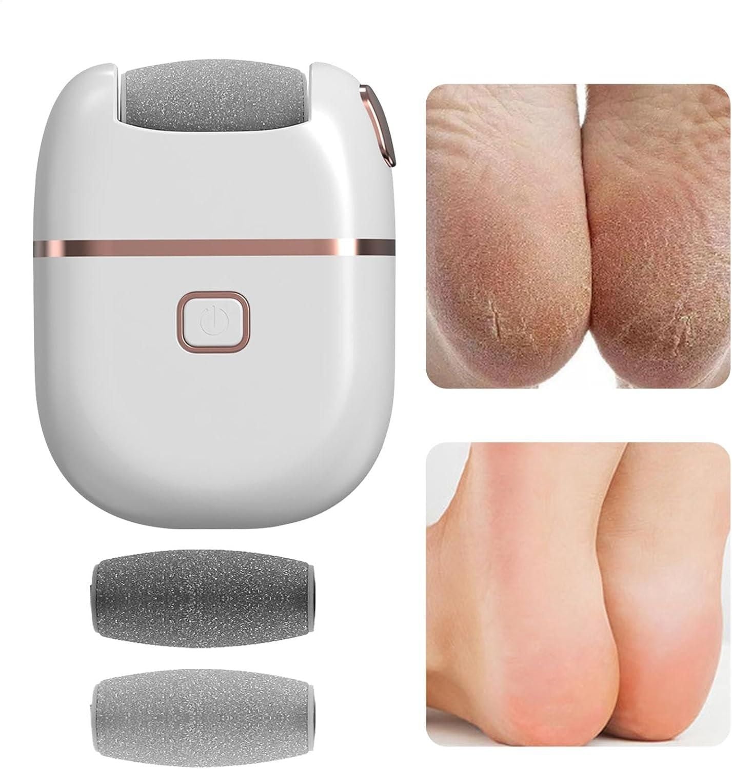 Electronic Pedicure Foot Grinder – Rechargeable Callus Remover & Dead Skin Exfoliator